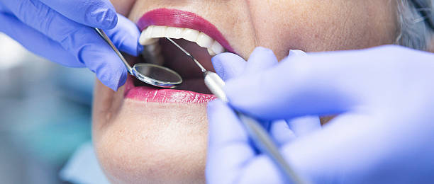 Best Emergency Wisdom Tooth Extraction in Woodlynne, NJ